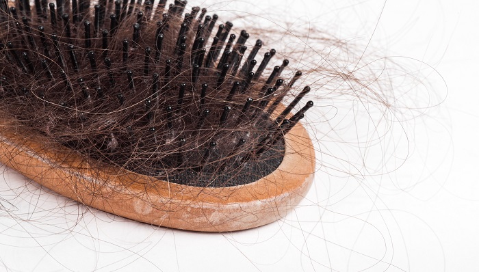 Hair Loss – Dream Meaning and Symbolism
